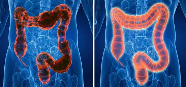 Colon Balance - Vivez léger au quotidien